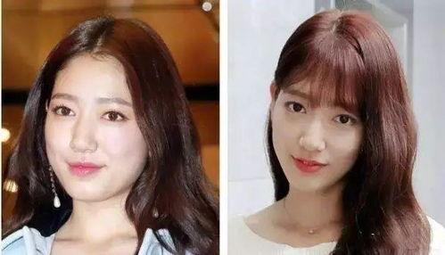 女明星减肥脱发,减肥同时告别脱发困扰